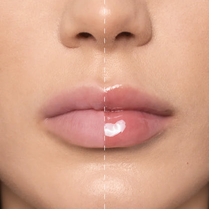 LIPOILOGY 103 RUBY FUSION Mesauda